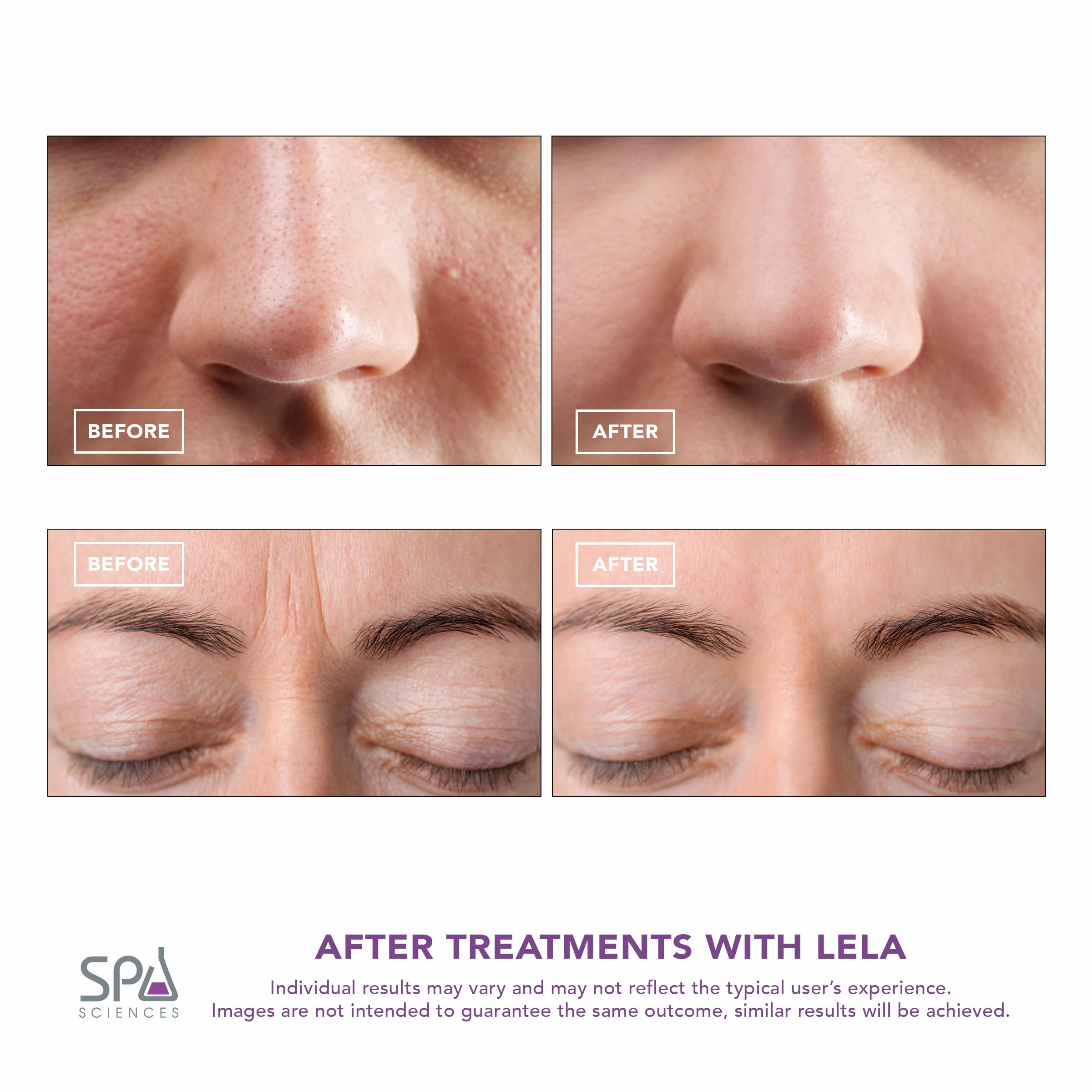 Spa Sciences LELA serum-infusion mode enhances product penetration.