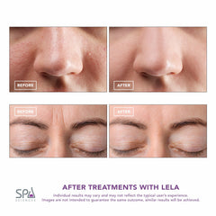Spa Sciences LELA serum-infusion mode enhances product penetration.