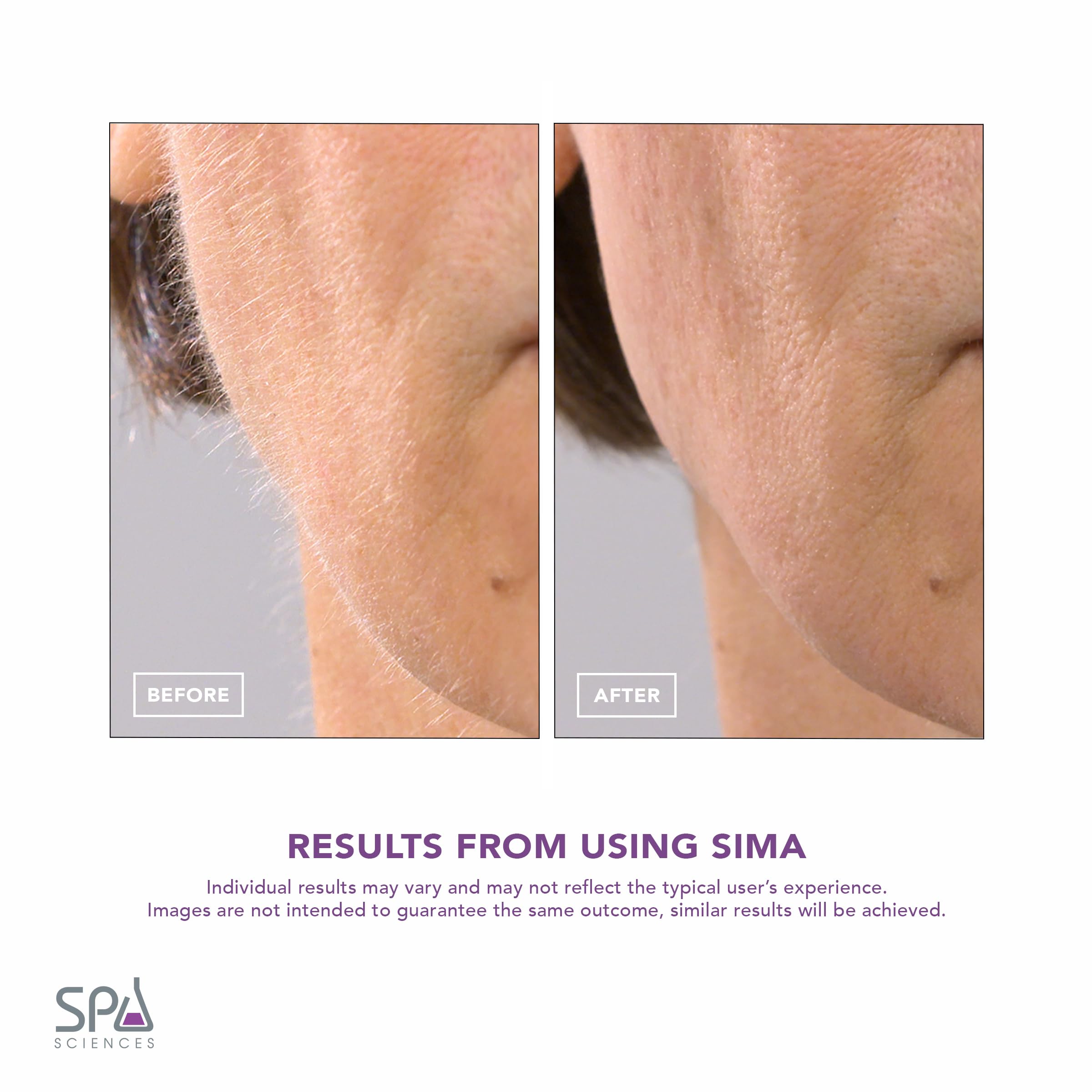 SPA SCIENCES SIMA dermaplaning action removes peach fuzz on the face