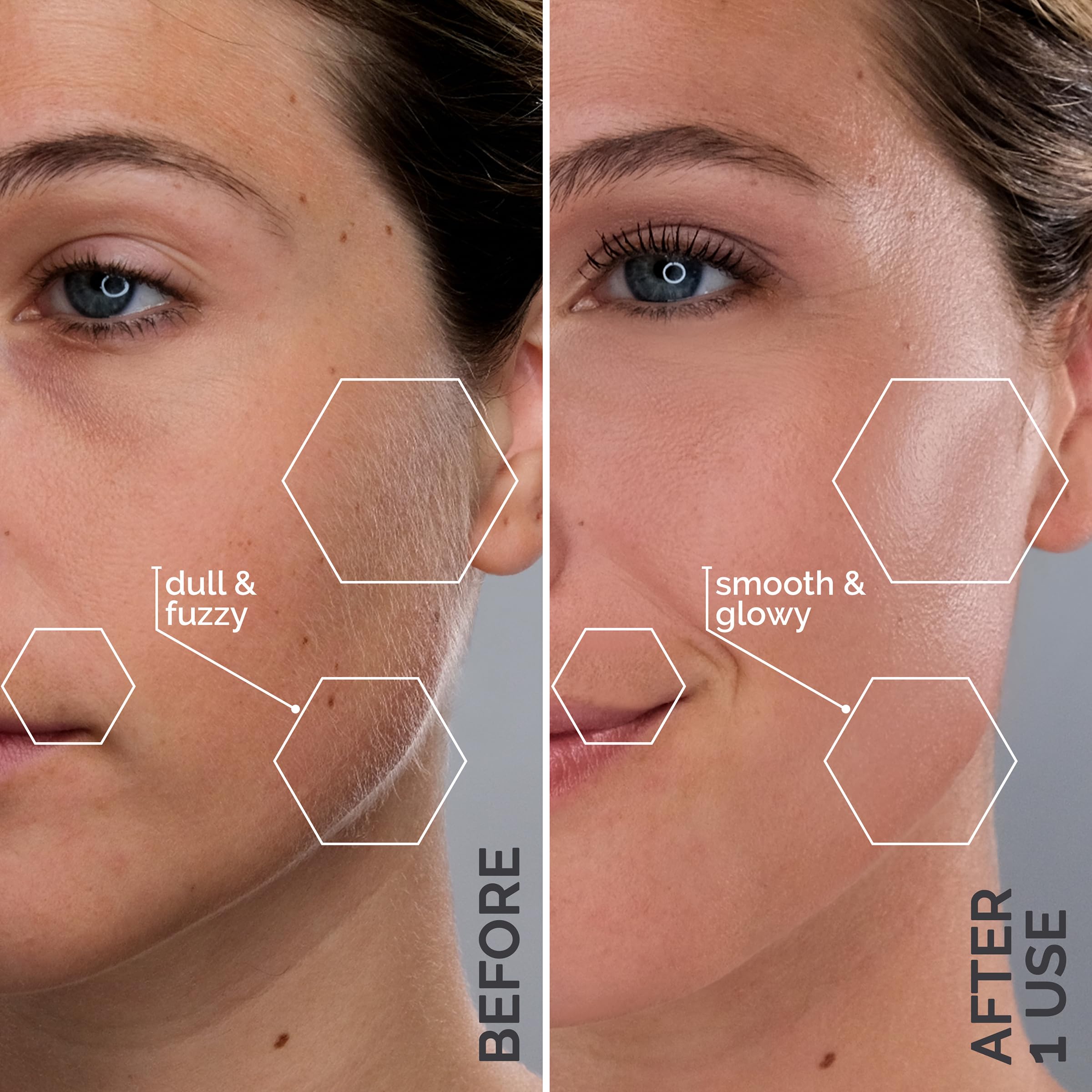 SPA SCIENCES SIMA dermaplane razor helps refine pores and skin texture