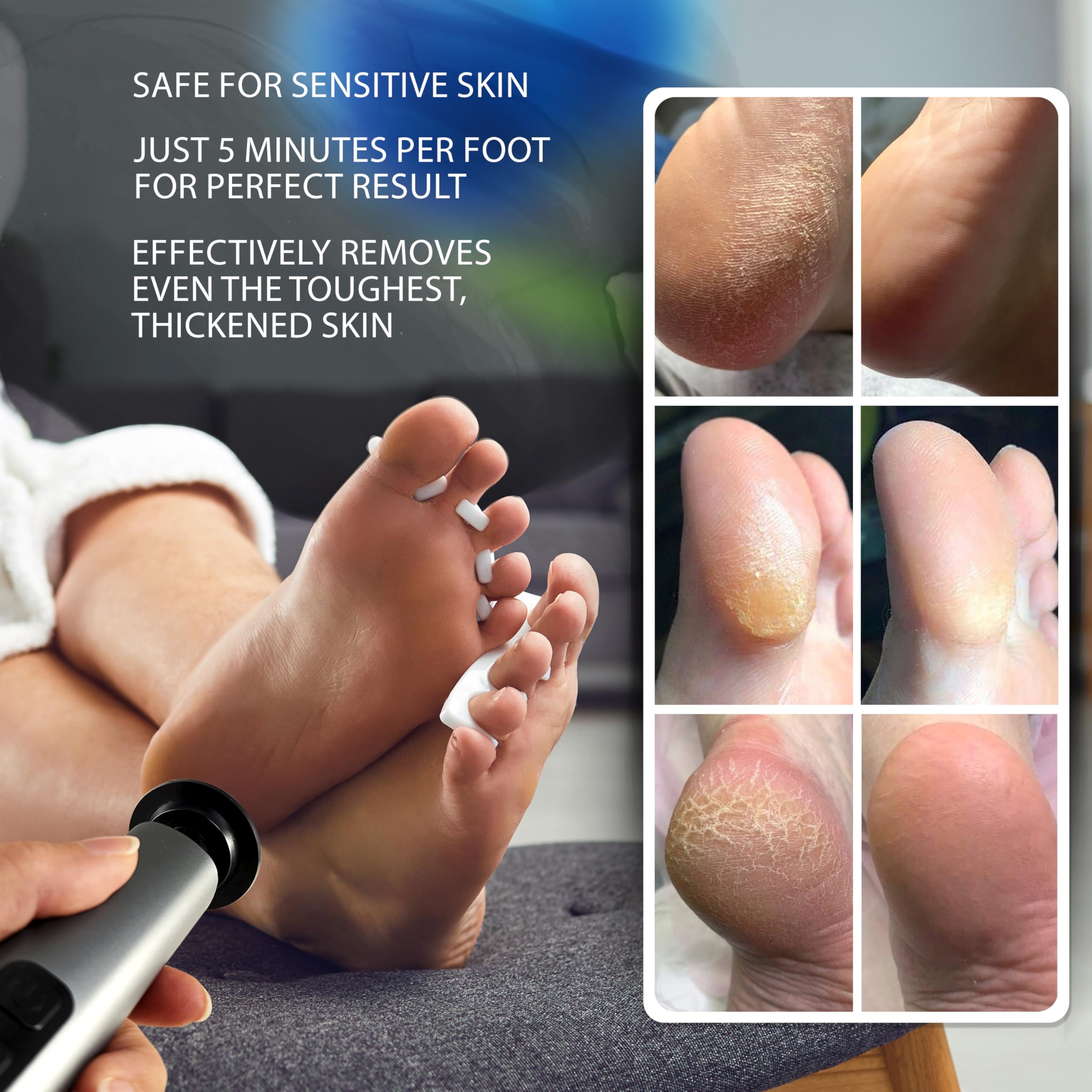 SPARGOS at home pedicure results for smooth feet