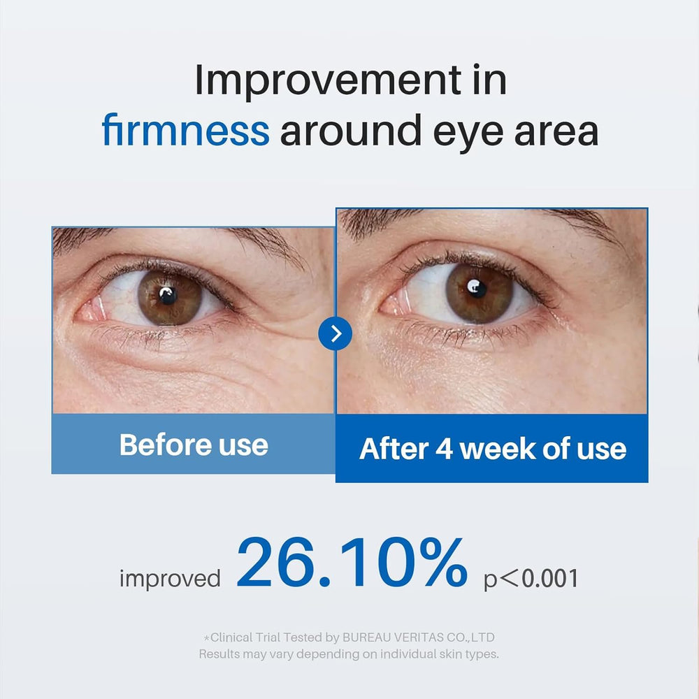 SPODARE caffeine eye cream contains retinol, squalane, and peptides for support