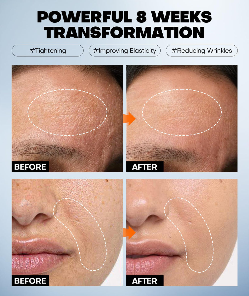 Srripo Radiant Glow mask graphic emphasizes hyaluronic acid hydration