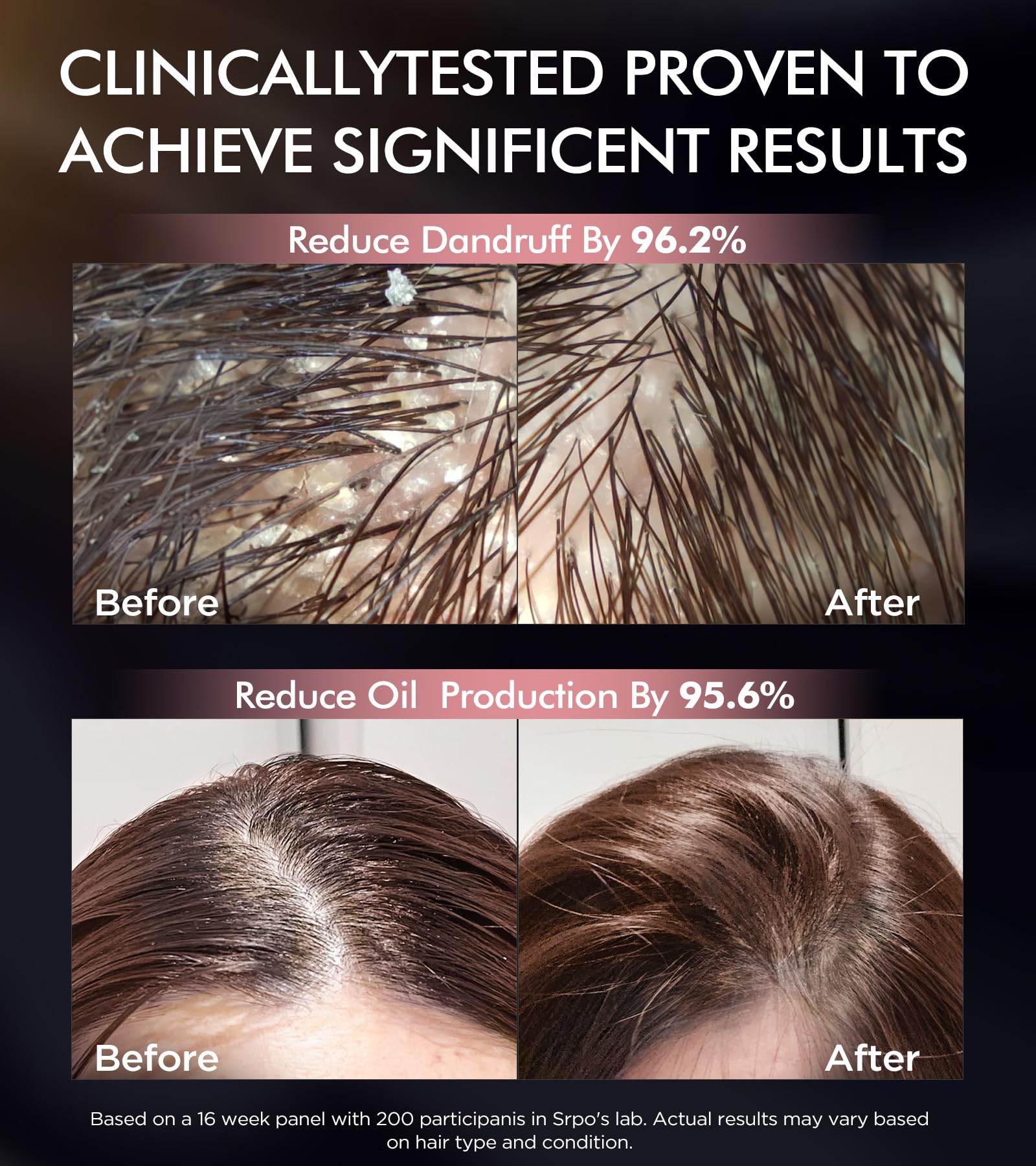 Srripo silky-shine result after wash photo