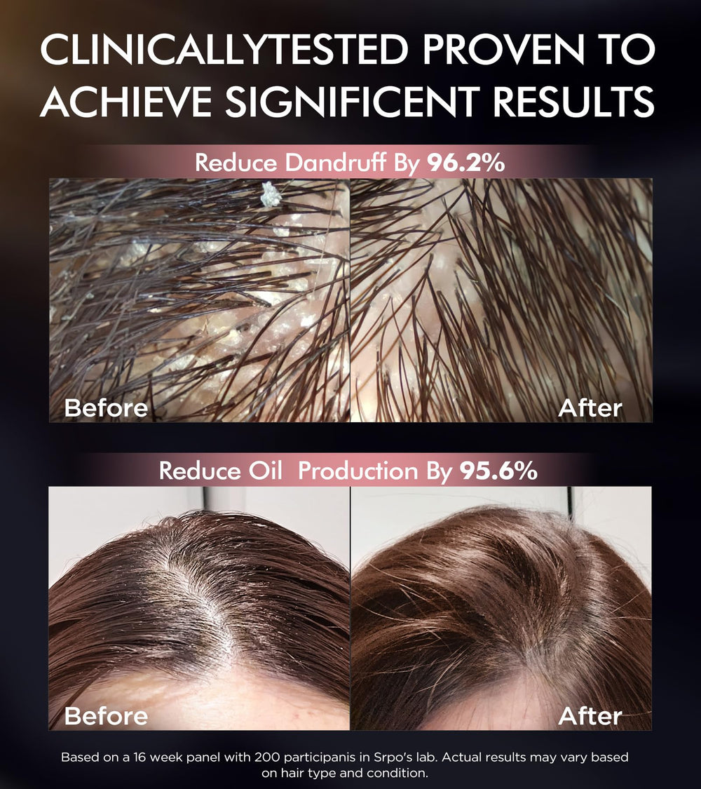 Srripo silky-shine result after wash photo
