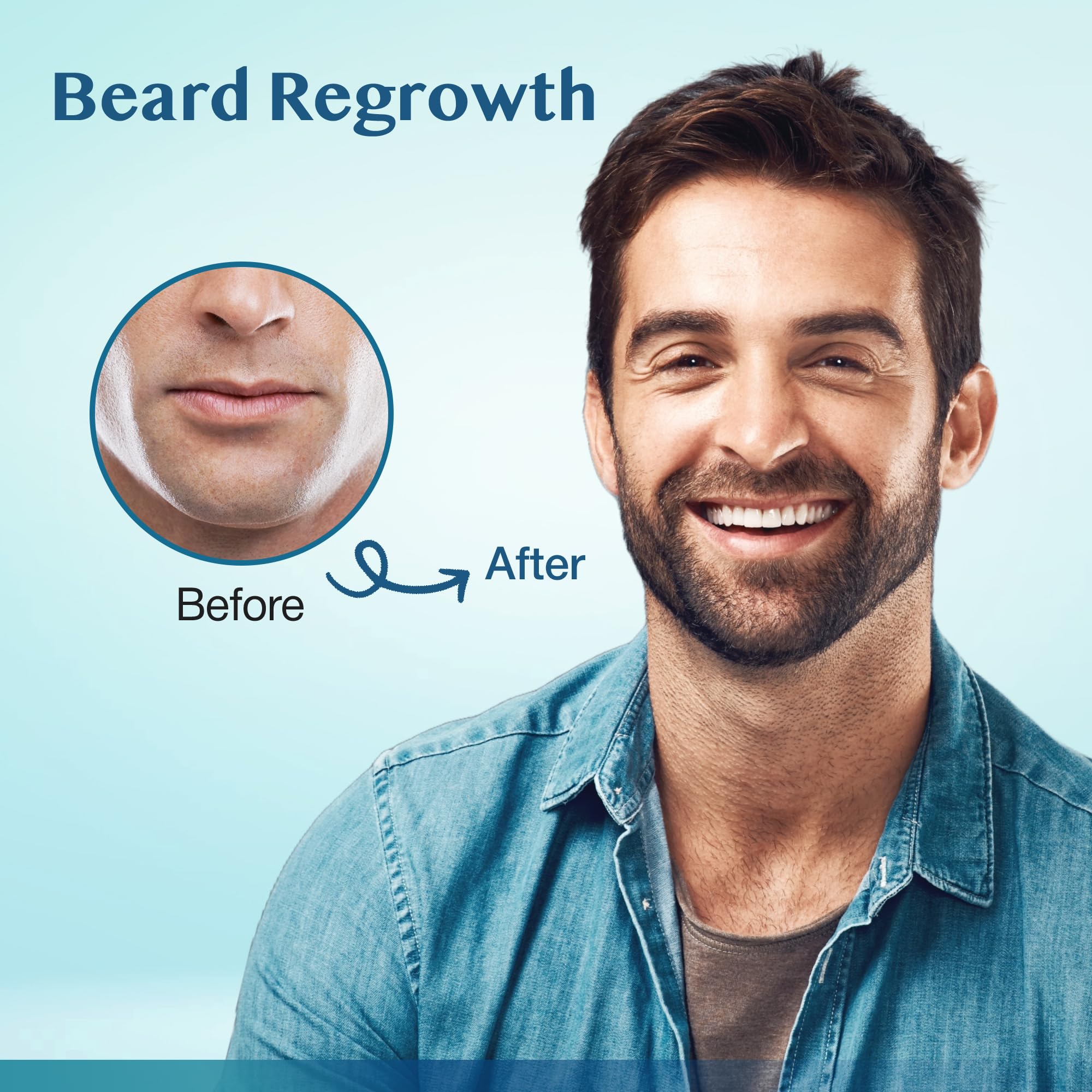 Stafenit beard regrowth zone demonstrates targeted beard treatment.