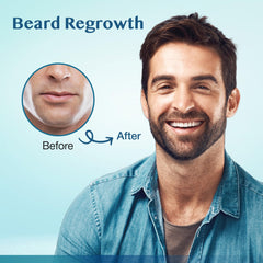Stafenit beard regrowth zone demonstrates targeted beard treatment.