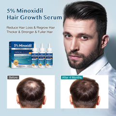 Stafenit thinning crown area shows focus on scalp density.
