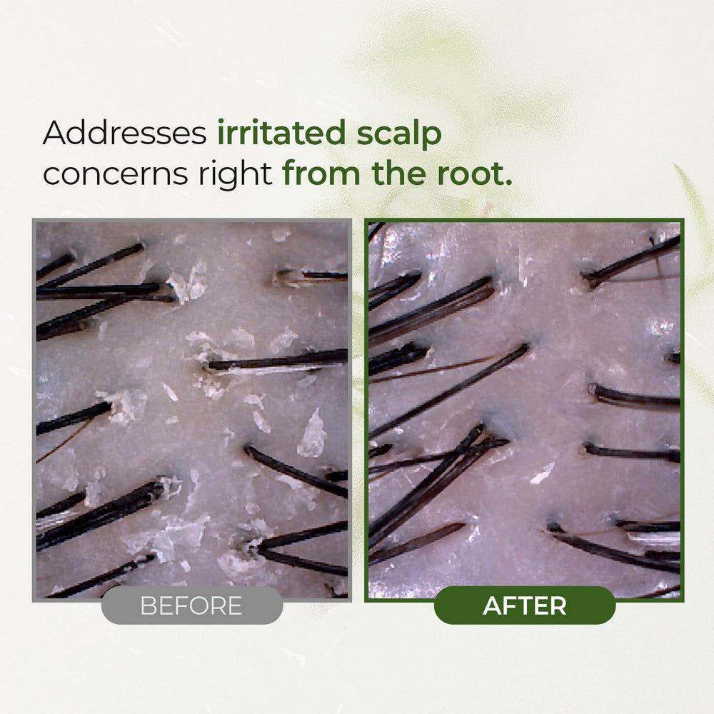 STEAMBASE Tea Tree Scalp Treatment emphasizes natural BHA from Black Willow Bark