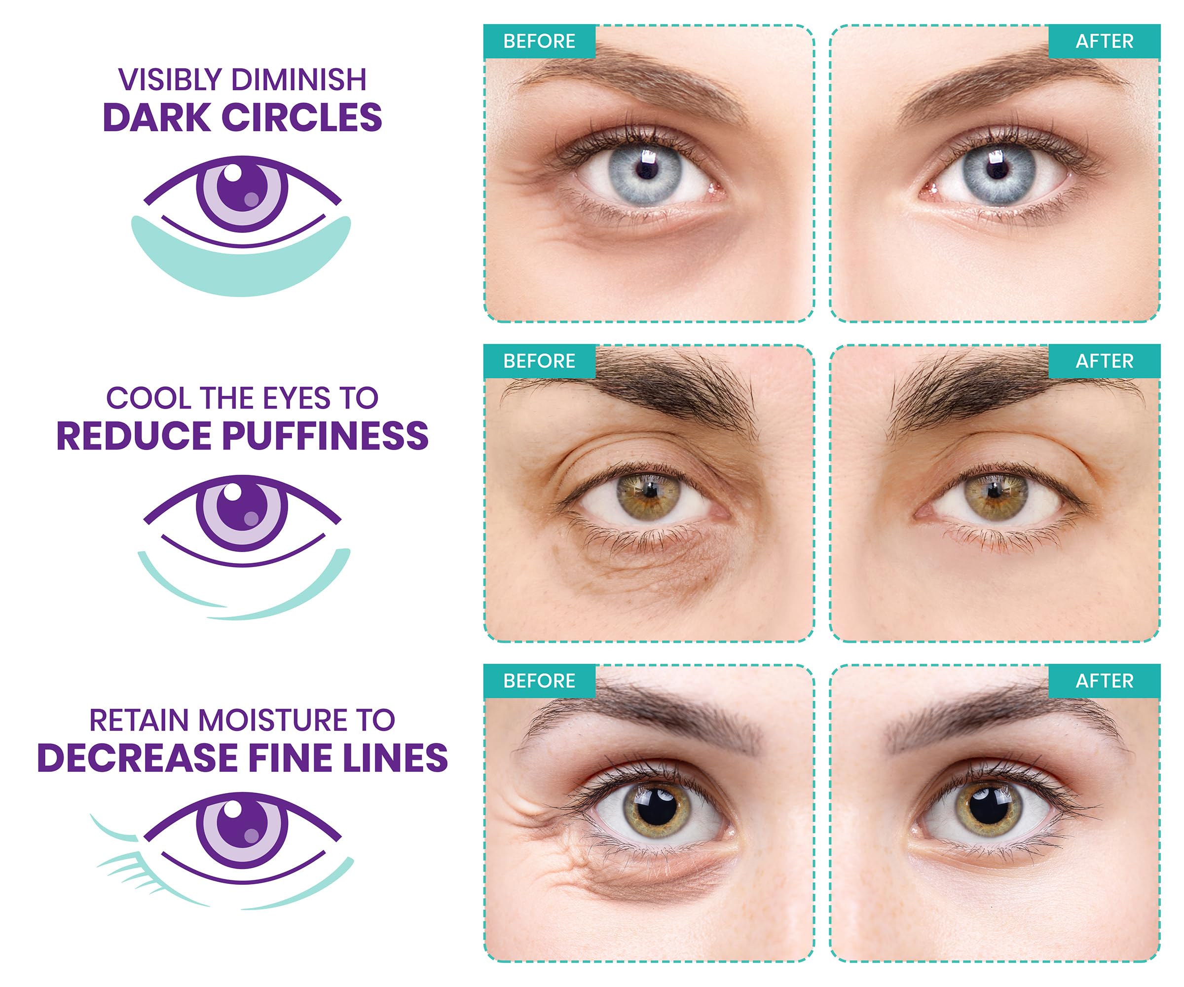 Stylia retinol vitamin C hyaluronic acid boost closeup demonstrates rejuvenating under-eye glow