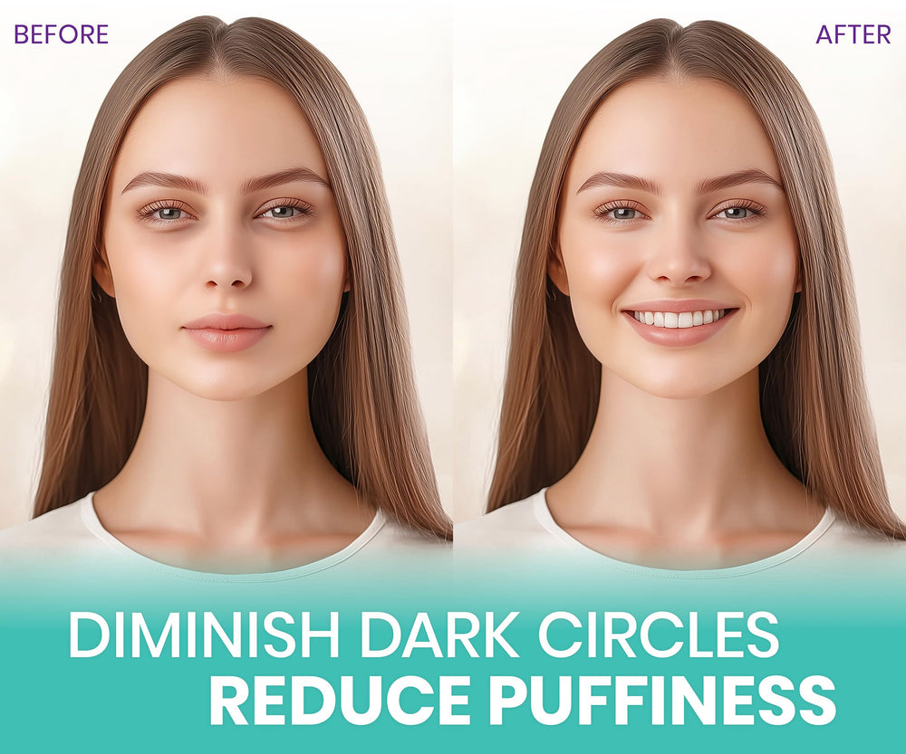 Stylia under-eye patches dark circles closeup brighten and refresh delicate skin