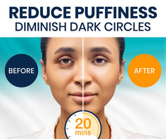 Stylia under-eye patches dark circles—visibly brighten and cool tired eyes.