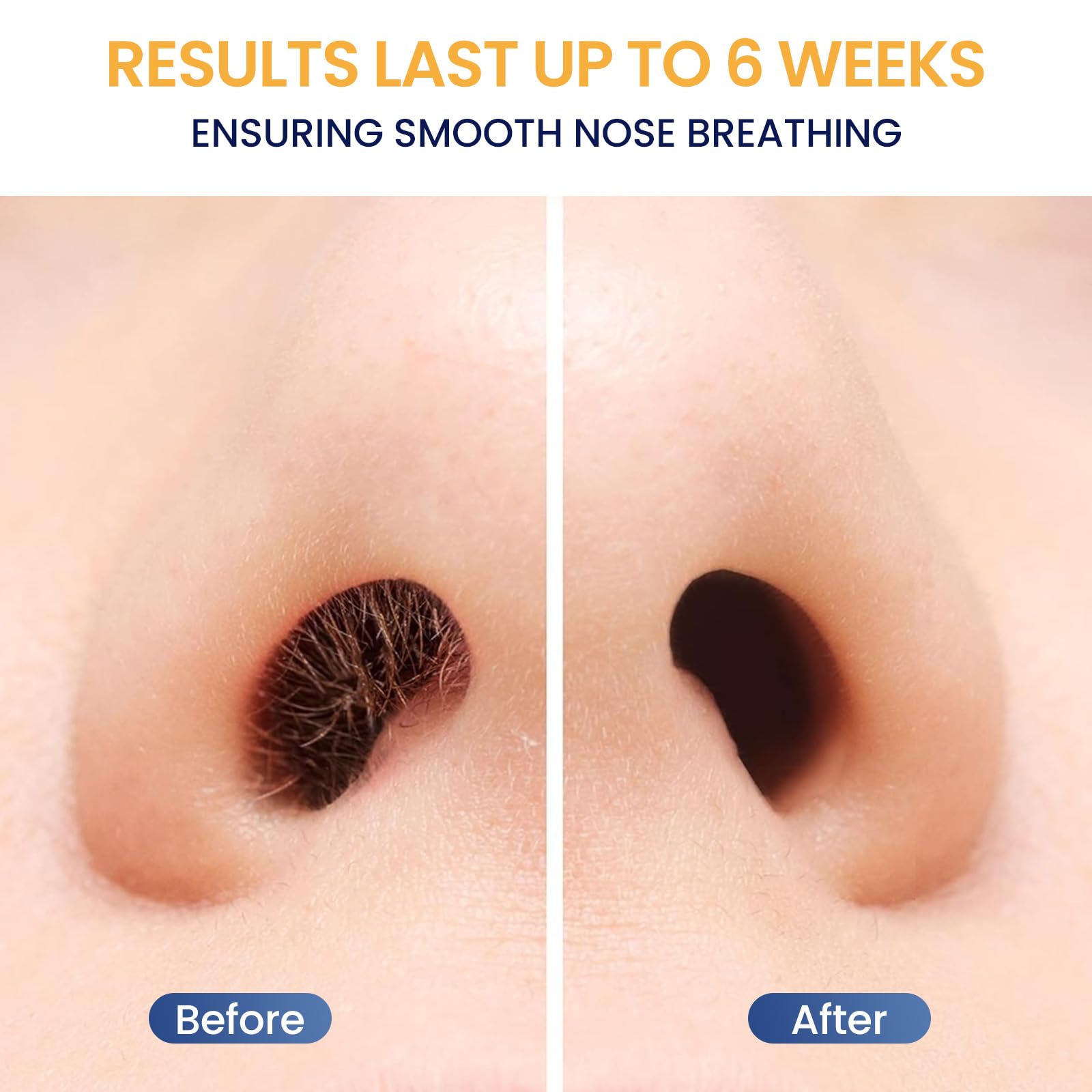 Suerbeauty nose-wax-kit ear-hair use helps maintain tidy hearing area.