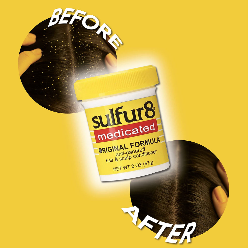Sulfur8 bottle with hair close-up showing dandruff control and comfort on the scalp.