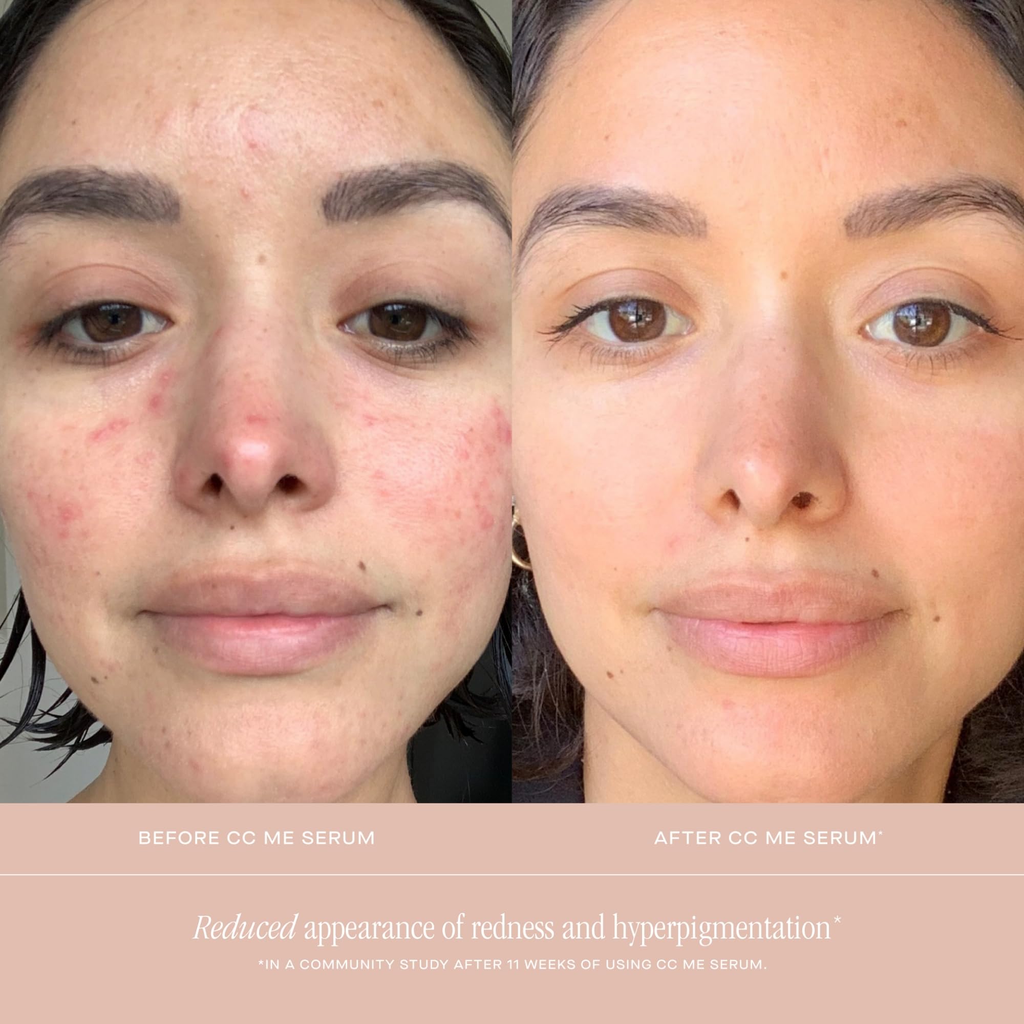 Summer Fridays CC Me Serum on skin for improved tone over time.