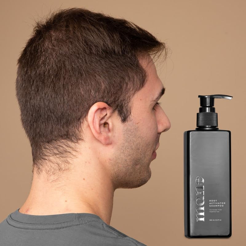 Superior Mane hair density before-after visuals illustrate volume enhancement possibilities.