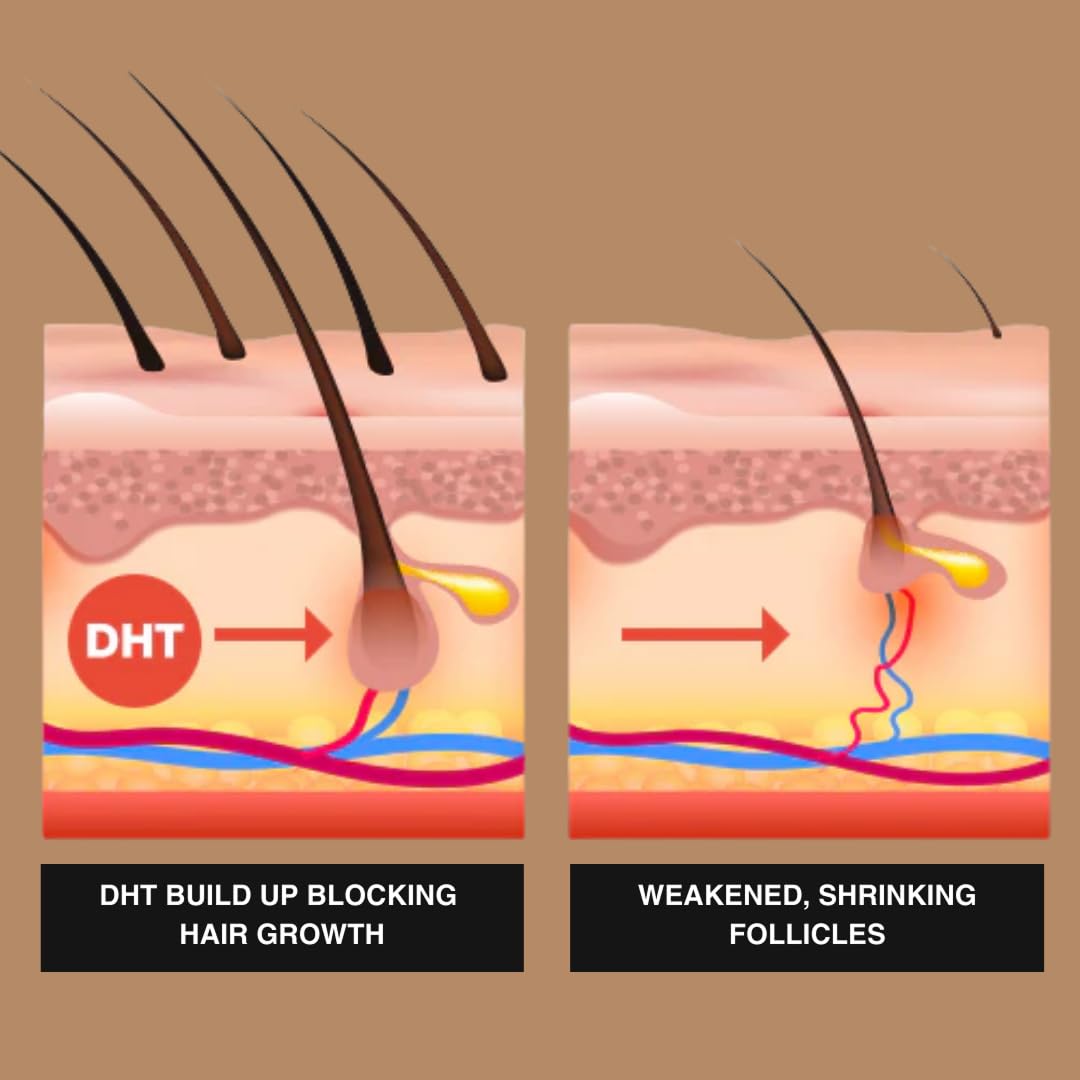 Superior Mane Root Activator application on damp hair reinforces volume and fullness