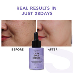 Suquato dark spot serum dispensing pump ensuring precise, clean application.
