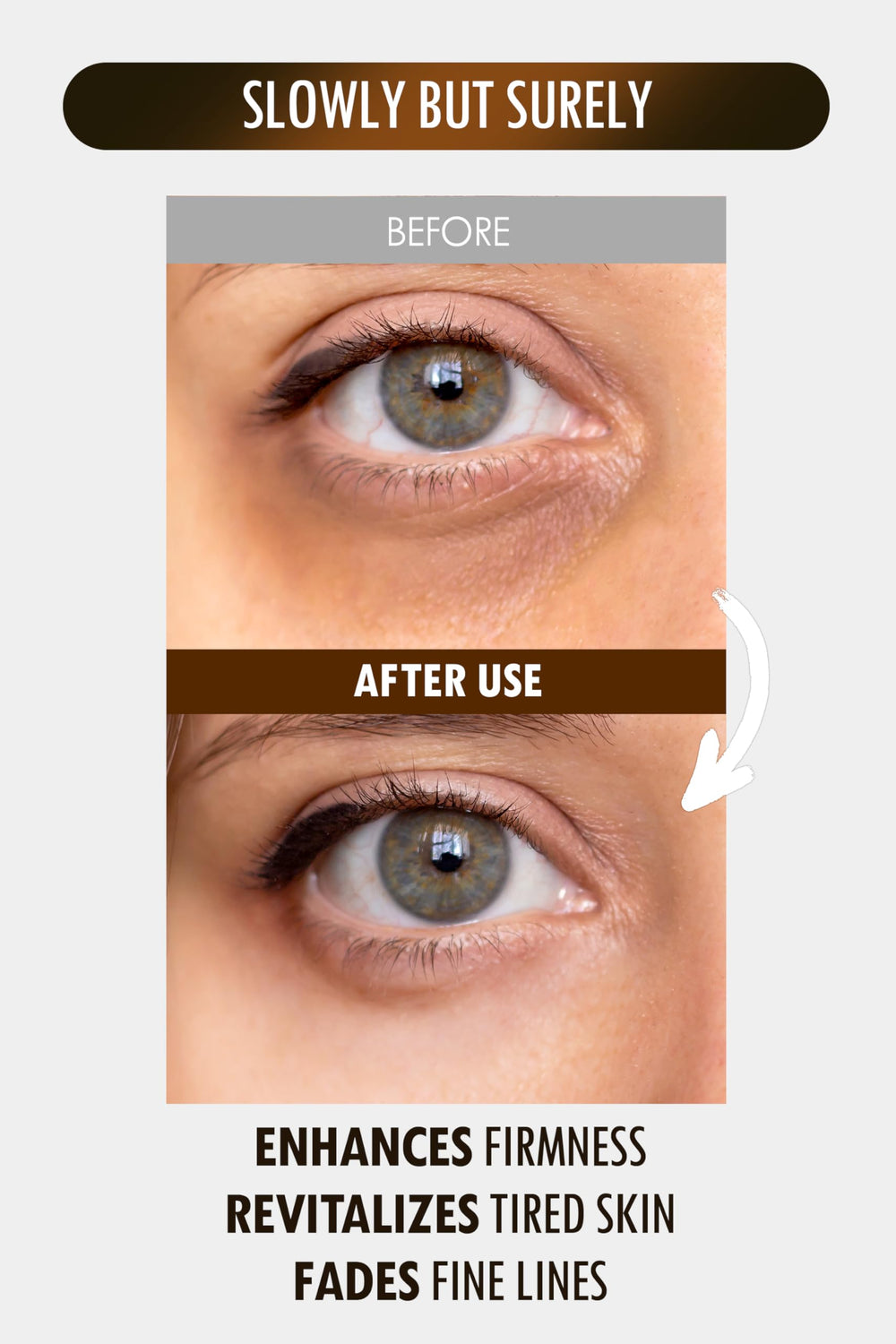SUR.MEDIC+ 24K Gold Perfection cream face application shows even coverage.