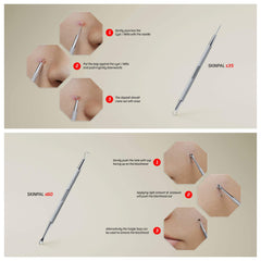 Suvorna 4-in-1 kit with French stainless steel construction for precise extractions.