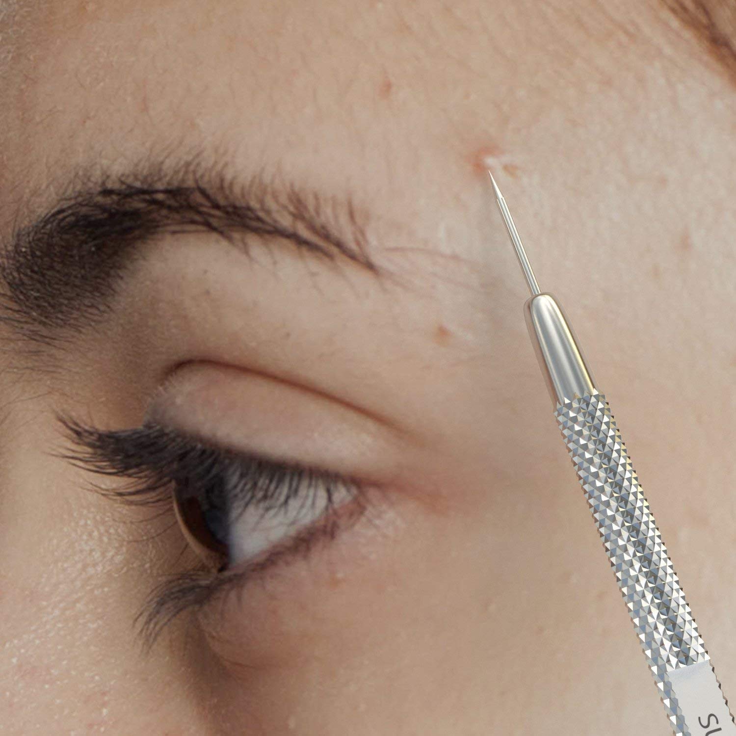 Suvorna comedone extractor tool for cysts and stubborn blemishes.