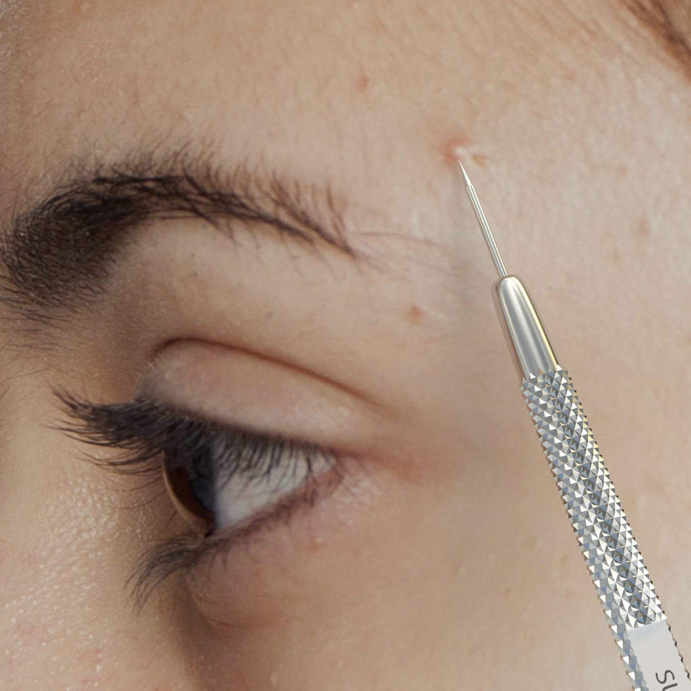 Suvorna comedone extractor tool for cysts and stubborn blemishes.