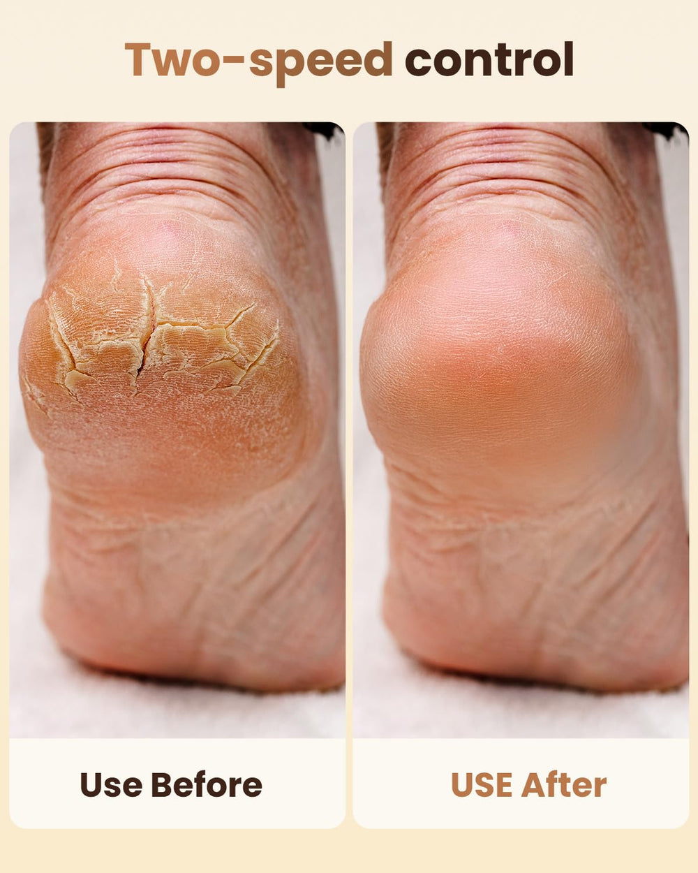 SVEMIN electric callus remover with digital display for precise power management.