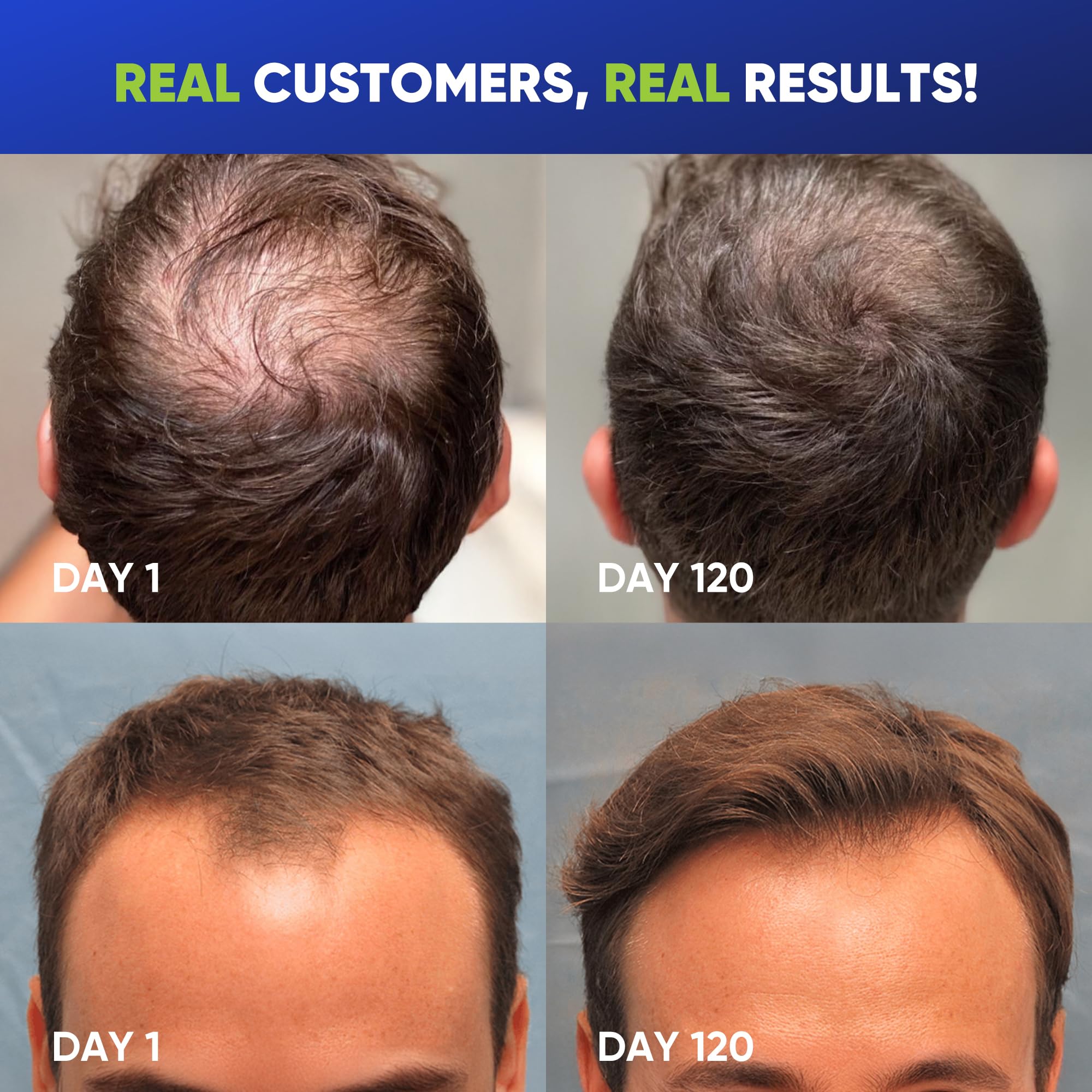 Svvimer Rosemary Tea Tree Oil ingredients panel emphasizes refreshing scalp notes.