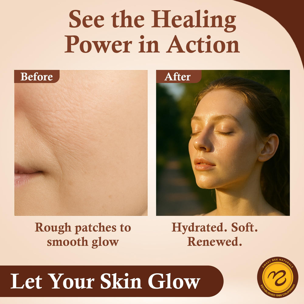 Sweet Bee Naturals balm on dry skin provides deep moisturization