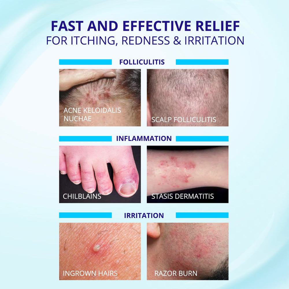 TAGRID Folliculitis Cream closeup texture highlights non greasy fast absorbing finish.