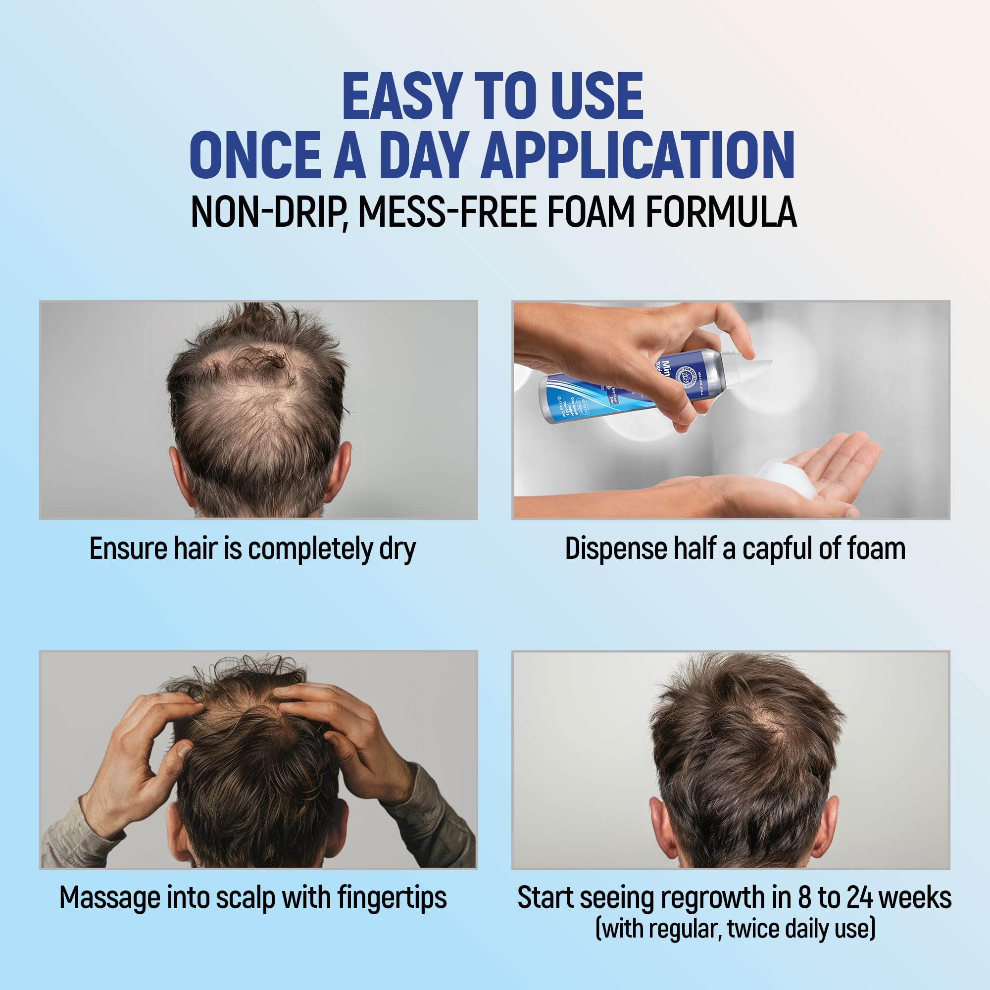 TARO minoxidil-application-on-scalp shows foam spreading across the scalp