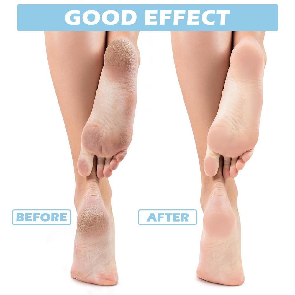Tarpop Aloe Socks gel infusion on soles delivers gradual moisture
