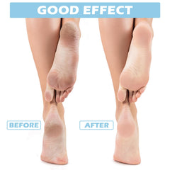 Tarpop Aloe Socks gel infusion on soles delivers gradual moisture