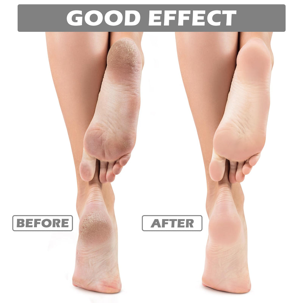 Tarpop Aloe Socks on feet bed-time scene suggests a soothing routine