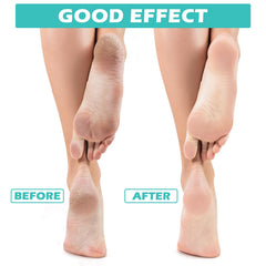 Tarpop Aloe Socks during sleep use promotes overnight softening.