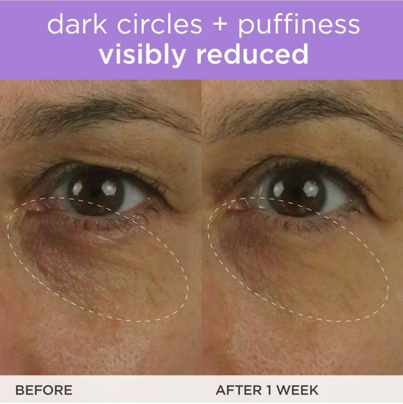 TATCHA Brightening Eye Cream close-up suggests subtle brightening around the eye area.