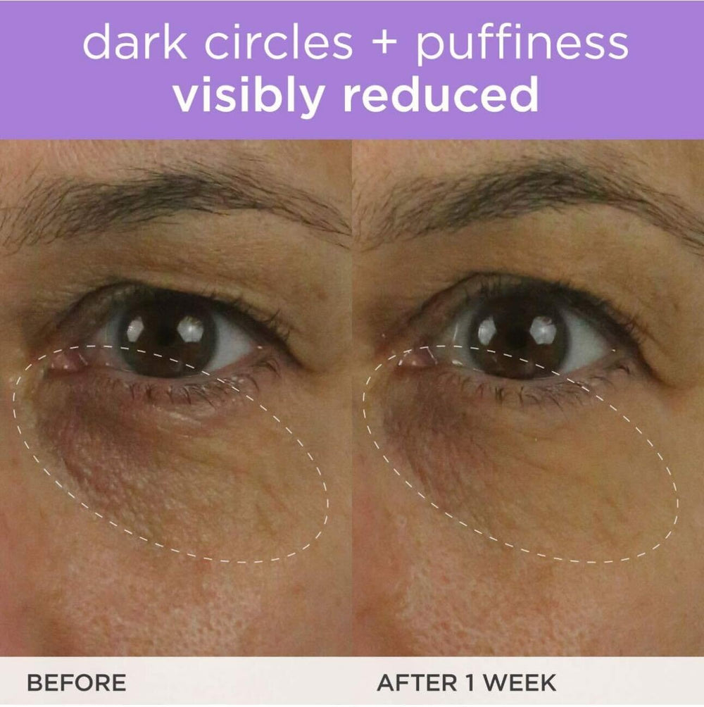 TATCHA Brightening Eye Cream close-up suggests subtle brightening around the eye area.