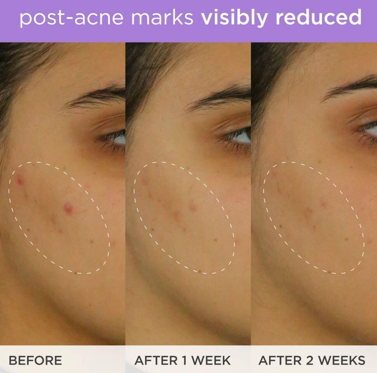 TATCHA The Brightening Serum massage-ready texture supports smoother complexion.