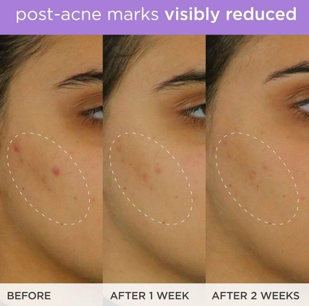 TATCHA The Brightening Serum massage-ready texture supports smoother complexion.