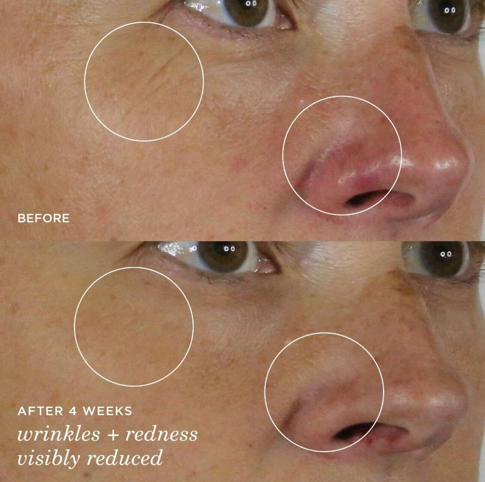 TATCHA Silk Serum sea fennel plant image suggests calming, redness-reducing care.