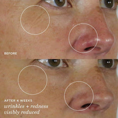 TATCHA Silk Serum sea fennel plant image suggests calming, redness-reducing care.