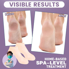 TEAWOO silicone socks elasticity-fit demonstrates flexible, comfortable wear for most feet.