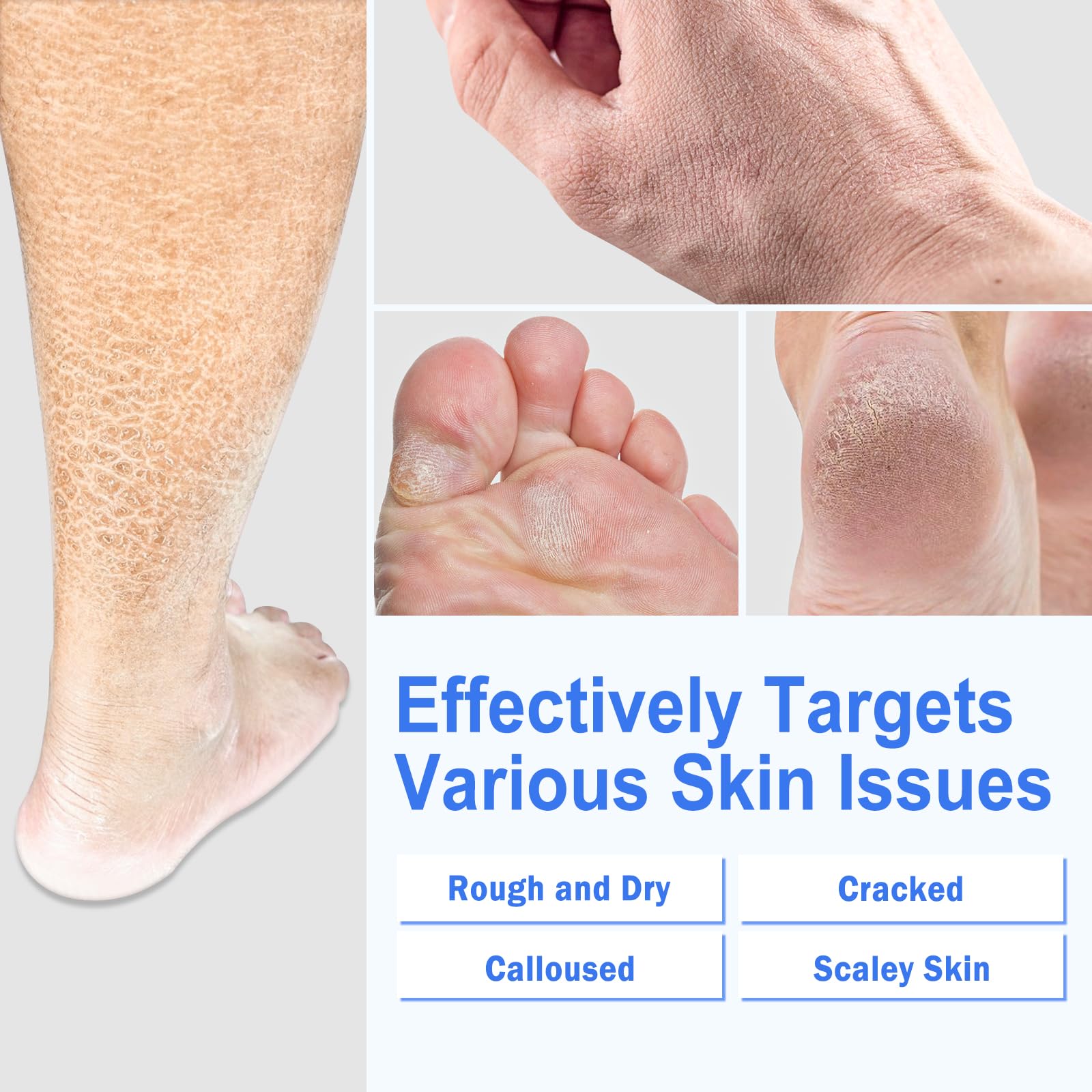 TEAWOO silicone socks on feet illustrate enhanced absorption with cream.