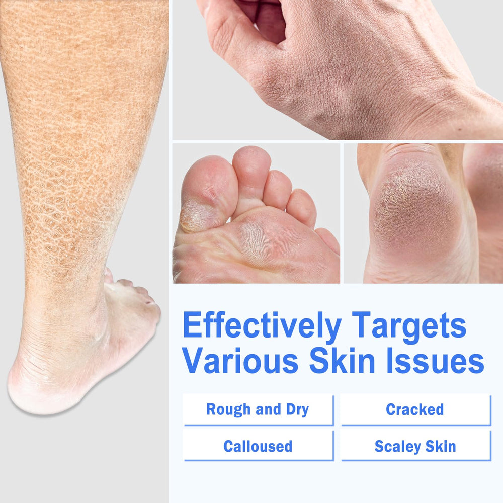 TEAWOO silicone socks on feet illustrate enhanced absorption with cream.