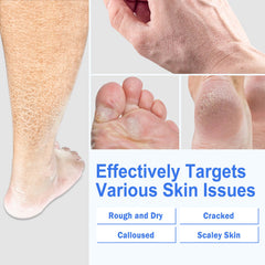 TEAWOO silicone socks on feet illustrate enhanced absorption with cream.