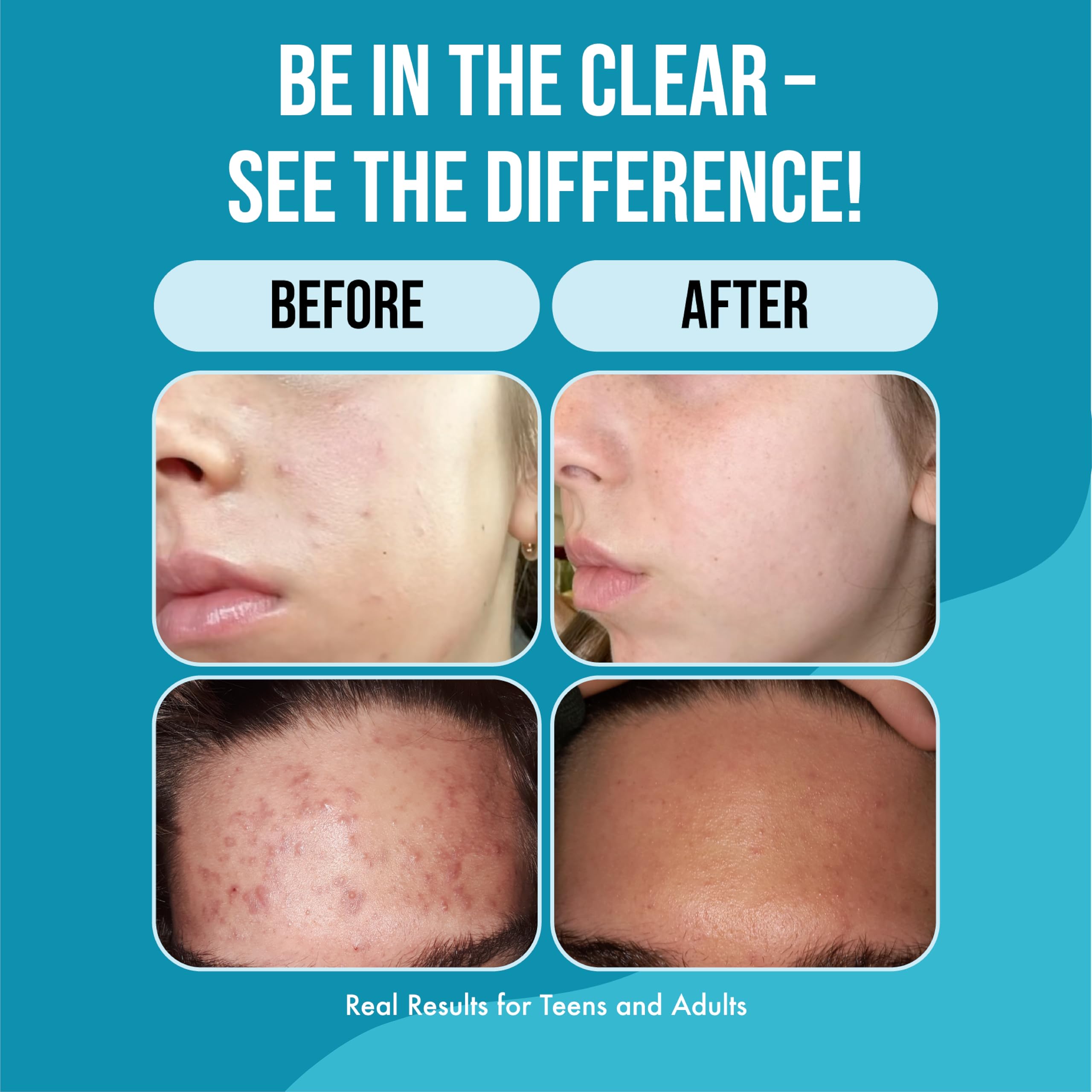 Teenology Teen Shampoo label close-up highlighting sulfate- and paraben-free formula.