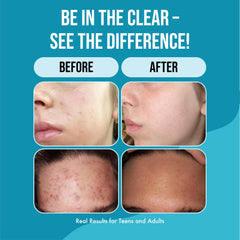 Teenology Teen Shampoo label close-up highlighting sulfate- and paraben-free formula.