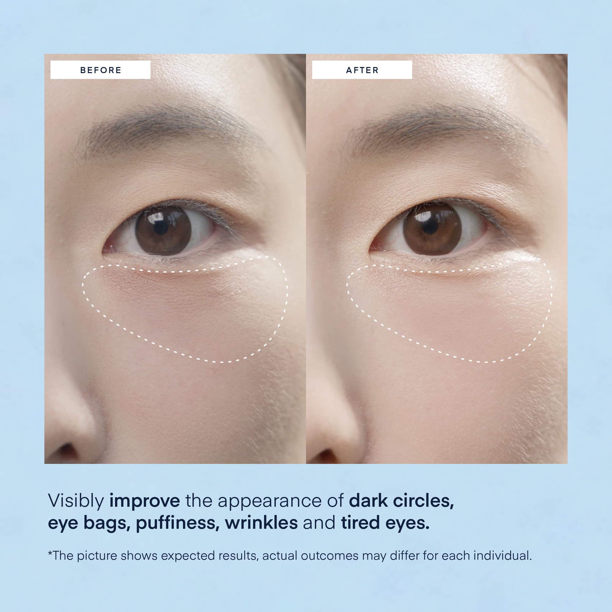 Terez & Honor caffeine-infused patches offer a wakeful look for the under-eye area.