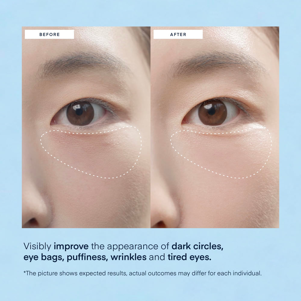 Terez & Honor caffeine-infused patches offer a wakeful look for the under-eye area.