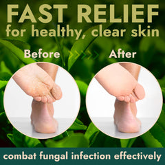 Terramed Just Think Comfort Foot Scrub with glycolic acid for gentle skin turnover.